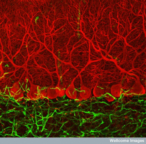 Music and Dance: Good ChemistryMusic andphoto credit: wellcome images 